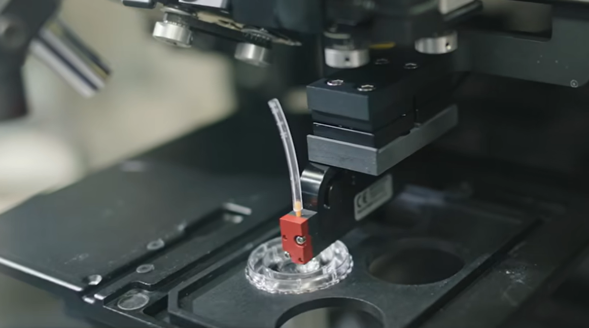 Precise Bio Treats First Patient With 3D Bioprinted Corneal Implant