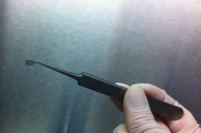 USC Roski Eye Takes Part in Phase IIb Trial of RPE Patch Candidate for GA