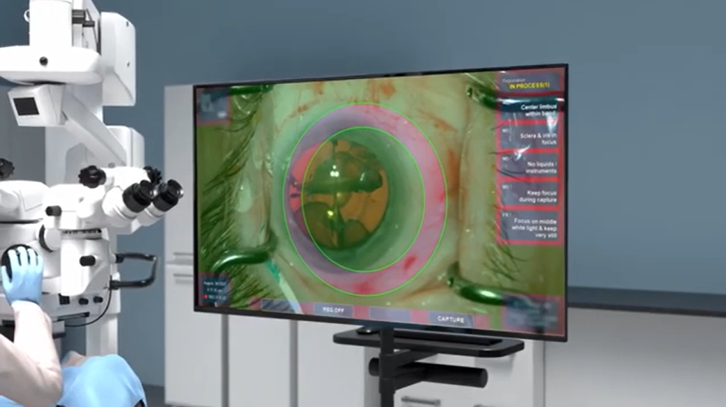 Cassini Gains MDR Approval for Surgical Guidance System in the EU