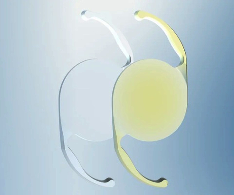 Alcon’s Clareon Monofocal Lens Gains MDR Certification, Expanded Labeling